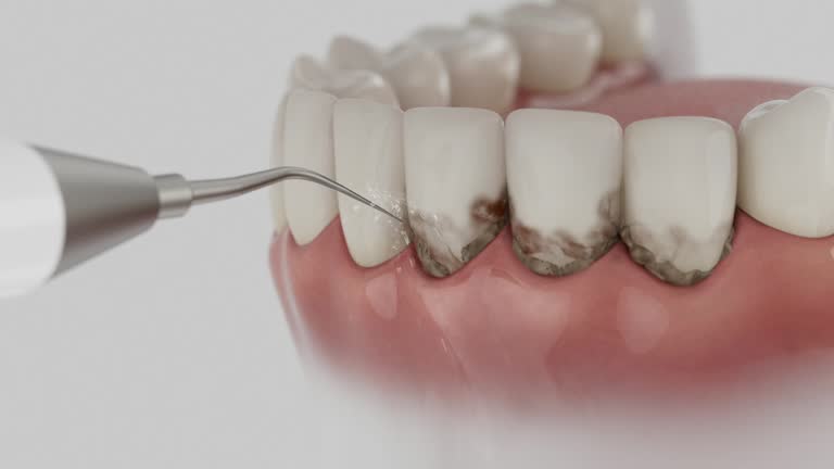 Trusted Root Canal Treatment service in Glen Gardner, NJ - Dentist Open Now
